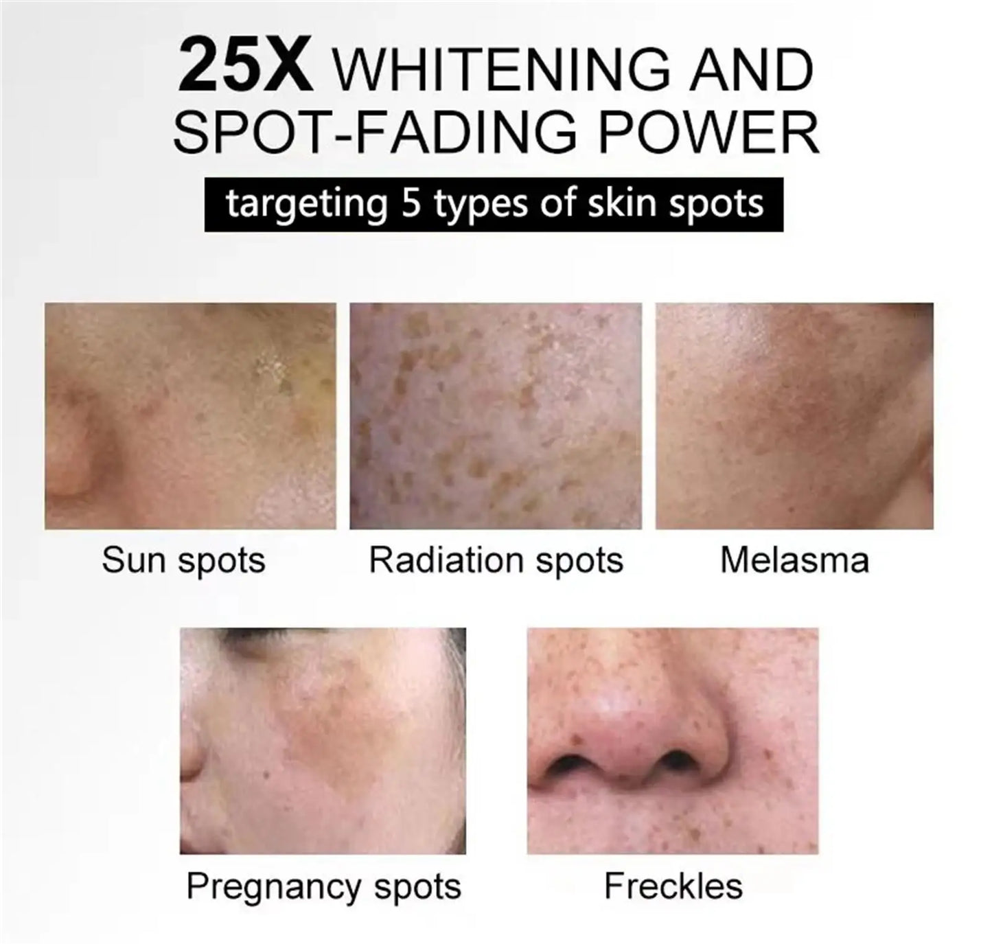 Dark Spots Remover Whitening Serum Face Freckle Melanin Correcting Anti Pigmentation Brighten Beauty Korean Day Night Skin Care