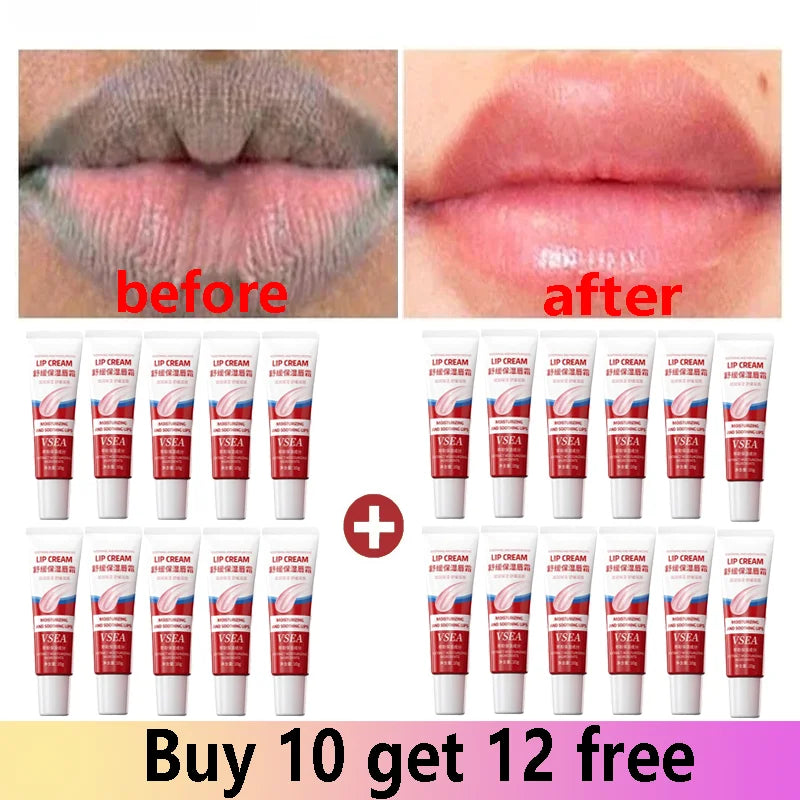 Remove Dark Lip Balm Fast Lightening Pink Lip Exfoliating Fade Lip Line Dead Skin Moisturizer Korean Care Products Beauty Health