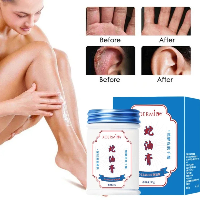 Beauty Product Herbal Anti Crack Foot Cream Heel Cracking Repair Products Exfoliation Dead Skin Removal Softening Moisturize