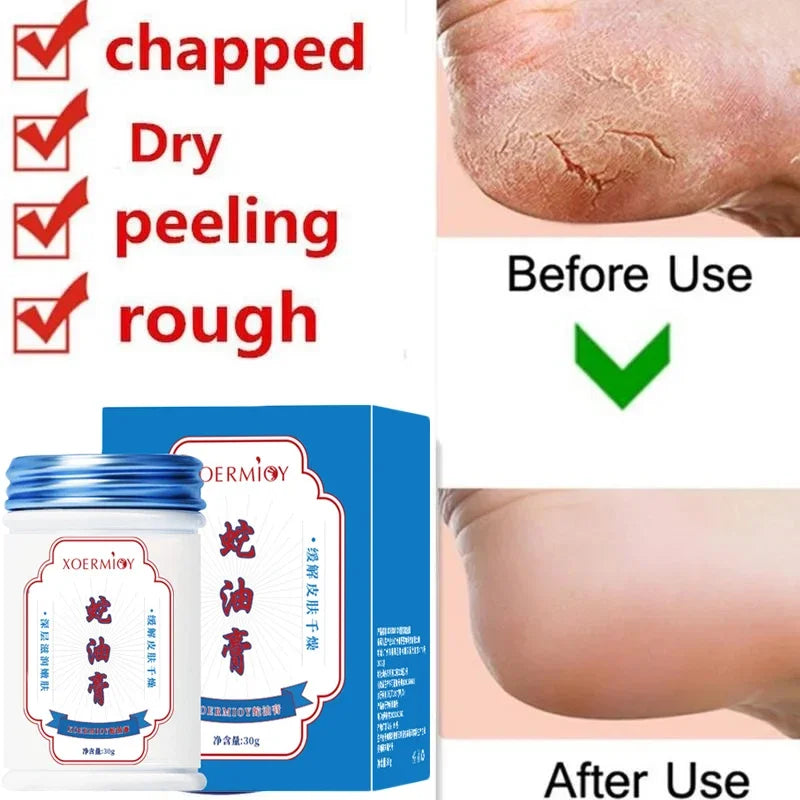 Beauty Product Herbal Anti Crack Foot Cream Heel Cracking Repair Products Exfoliation Dead Skin Removal Softening Moisturize