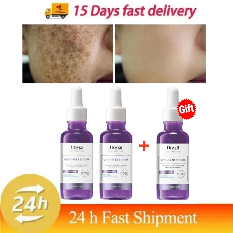 Dark Spots Remover Whitening Serum Face Freckle Melanin Correcting Anti Pigmentation Brighten Beauty Korean Day Night Skin Care