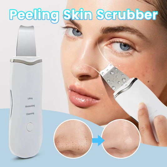 Professional Facial Skin Scrubber Ionic Deep Facial Cleaning Exfoliator Rechargeable Skin Care Device Beauty Instrument