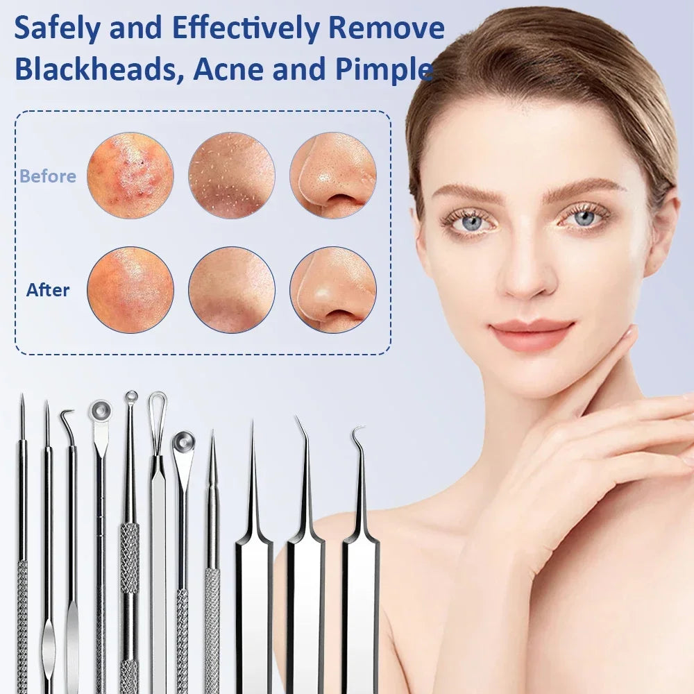 11Pcs/Set Acne Blackhead Removal Needles Black Dots Cleaner Pore Cleaner Deep Cleansing Face Skin Care Beauty Tools Needles Kit