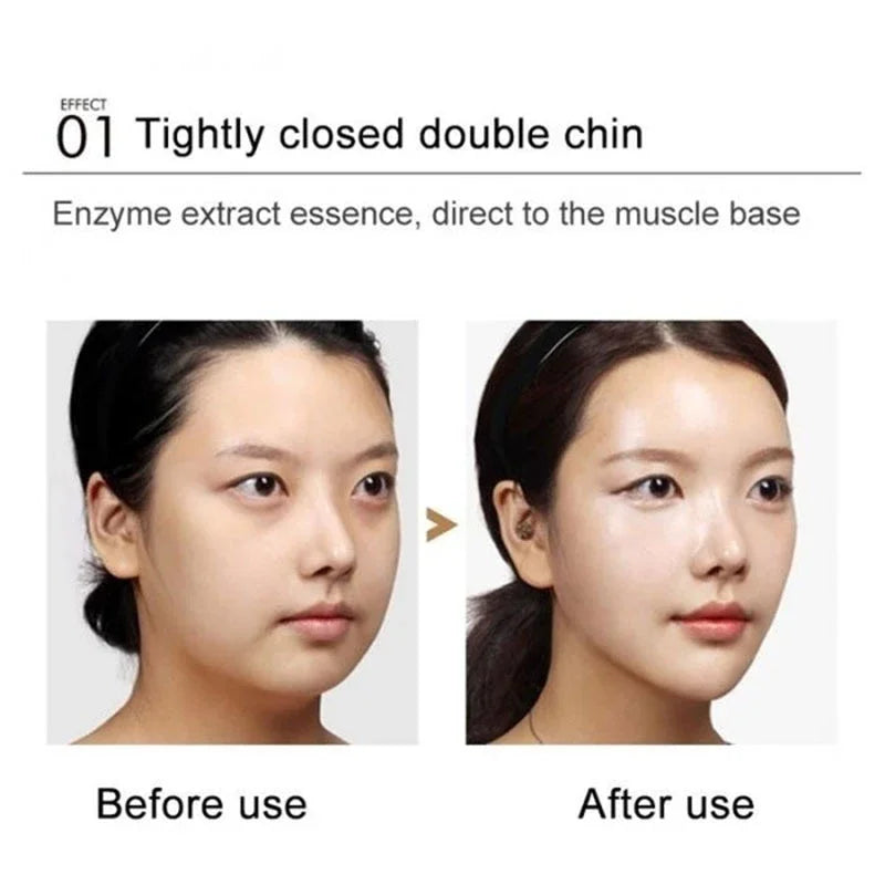 V-Shape Firming Face-lift Slimming Cream Removal Masseter Muscle Double Chin Face Fat Burning Anti-aging Products New