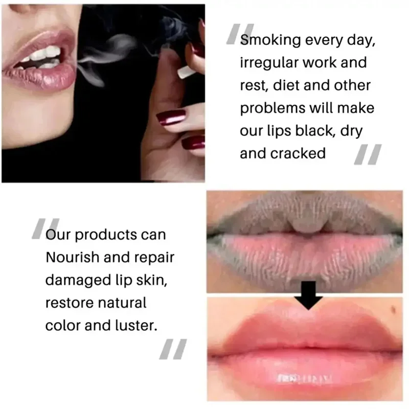 Remove Dark Lip Balm Fast Lightening Pink Lip Exfoliating Fade Lip Line Dead Skin Moisturizer Korean Care Products Beauty Health