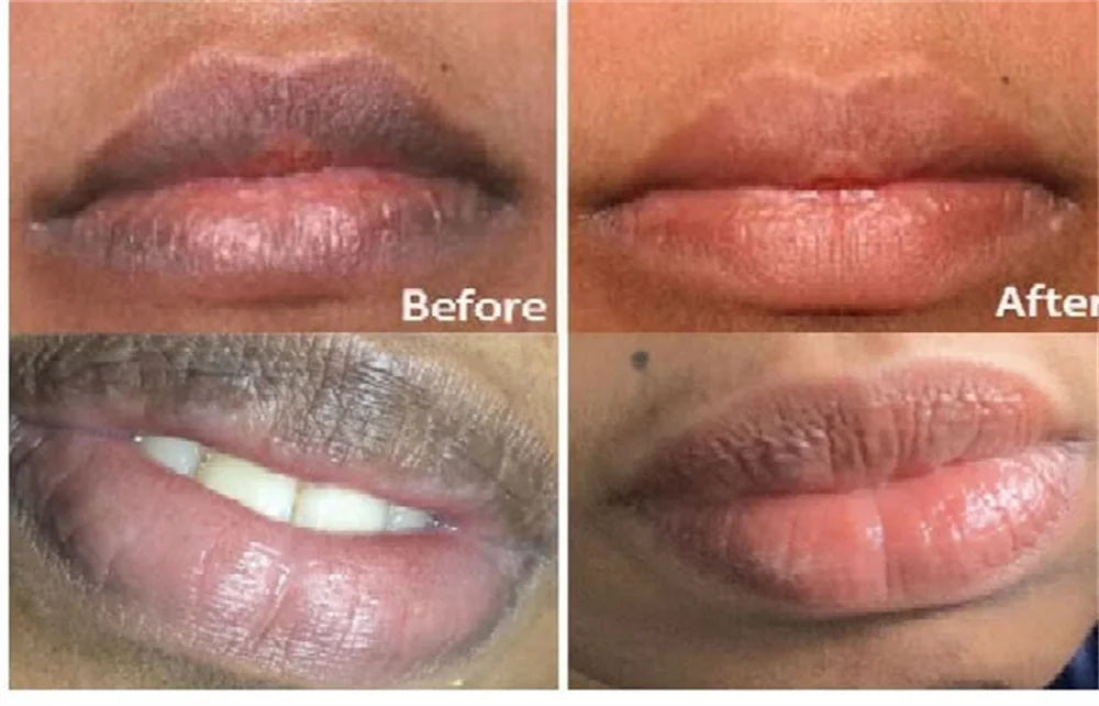 New Whitening Lip Balm Remove Dark Lighten Melanin Mask Exfoliate Dead Skin Fade Lip Line Moisturizer Brighten Repair Lips Care