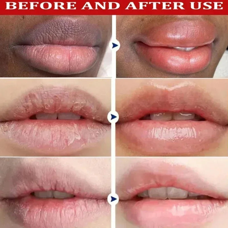 New Whitening Lip Balm Remove Dark Lighten Melanin Mask Exfoliate Dead Skin Fade Lip Line Moisturizer Brighten Repair Lips Care