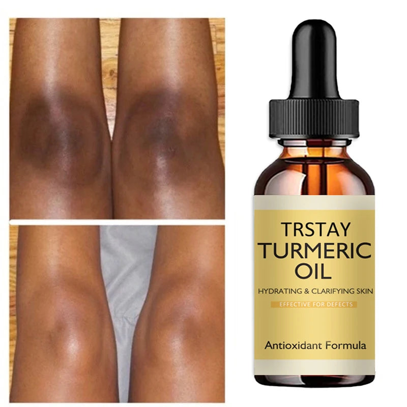 New Turmeric Oil Glow to Facial Lightening Serum For Black Brown Skin Leg Hand Body Whitening for Dark Skin beauty health