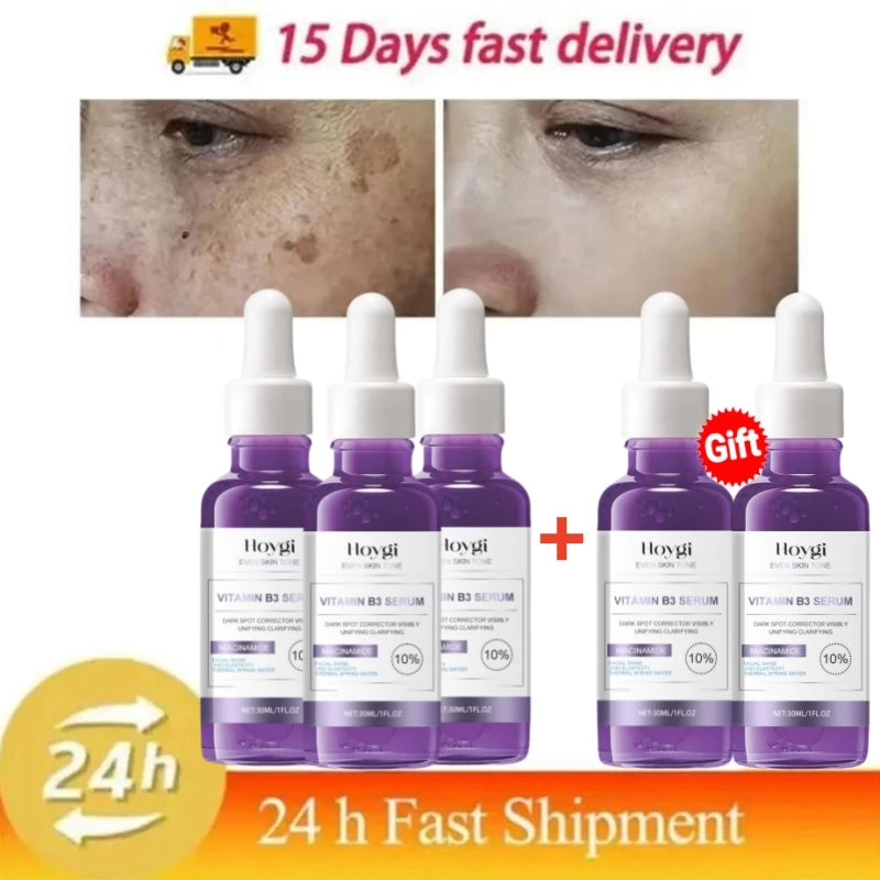 Dark Spots Remover Whitening Serum Face Freckle Melanin Correcting Anti Pigmentation Brighten Beauty Korean Day Night Skin Care