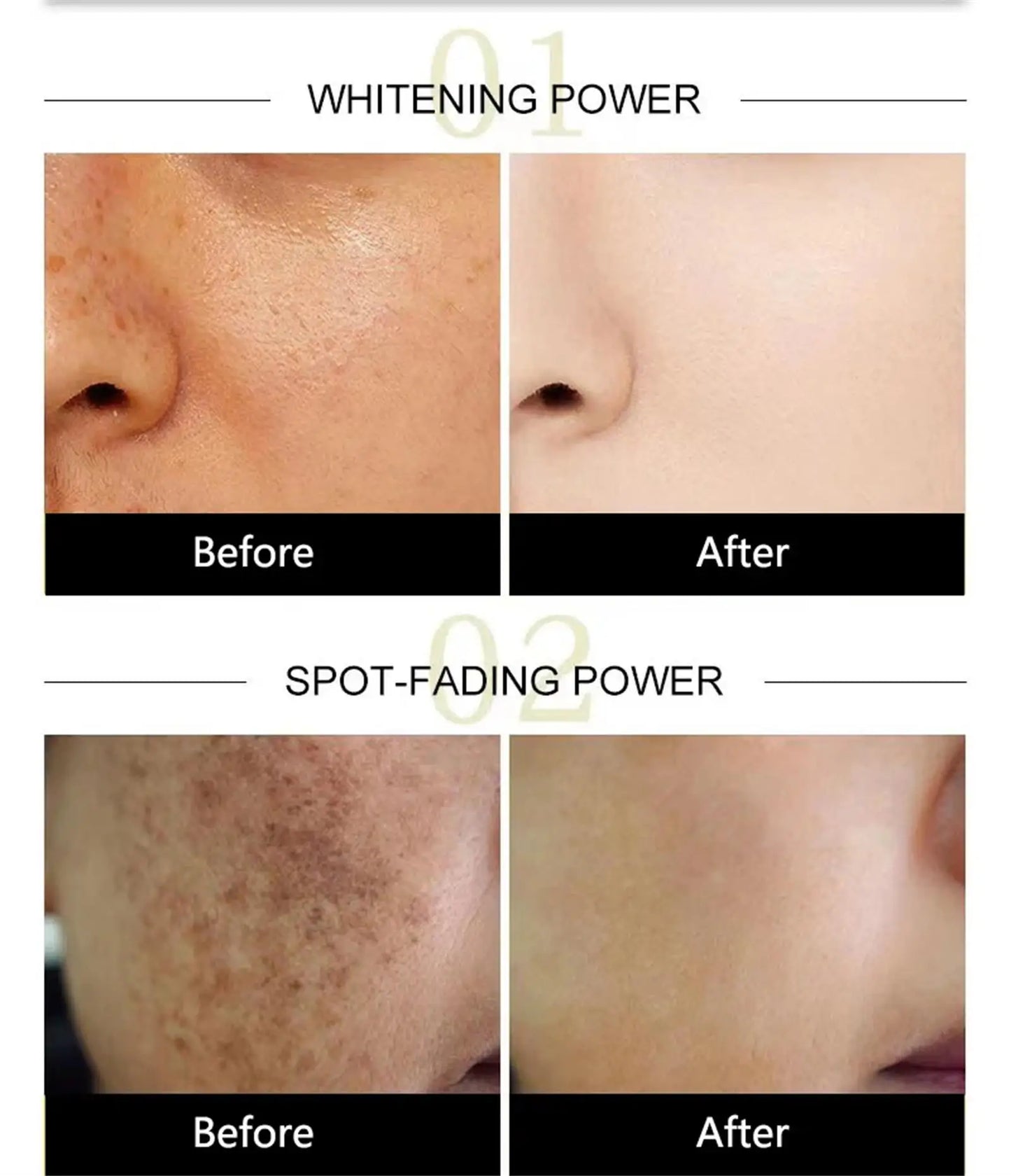 Dark Spots Remover Whitening Serum Face Freckle Melanin Correcting Anti Pigmentation Brighten Beauty Korean Day Night Skin Care