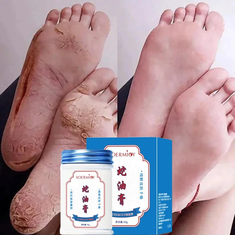 Beauty Product Herbal Anti Crack Foot Cream Heel Cracking Repair Products Exfoliation Dead Skin Removal Softening Moisturize