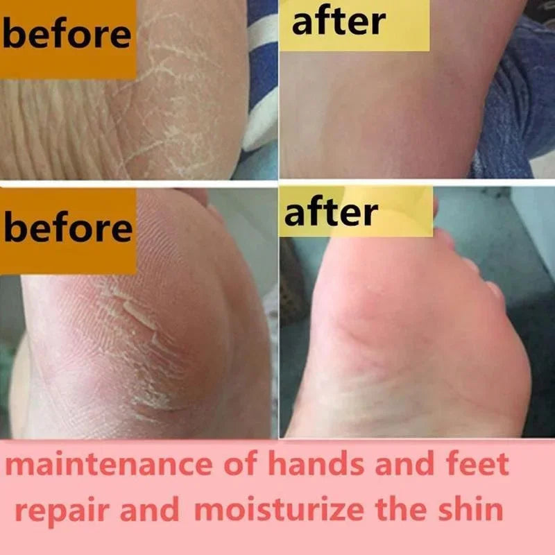 Beauty Product Herbal Anti Crack Foot Cream Heel Cracking Repair Products Exfoliation Dead Skin Removal Softening Moisturize