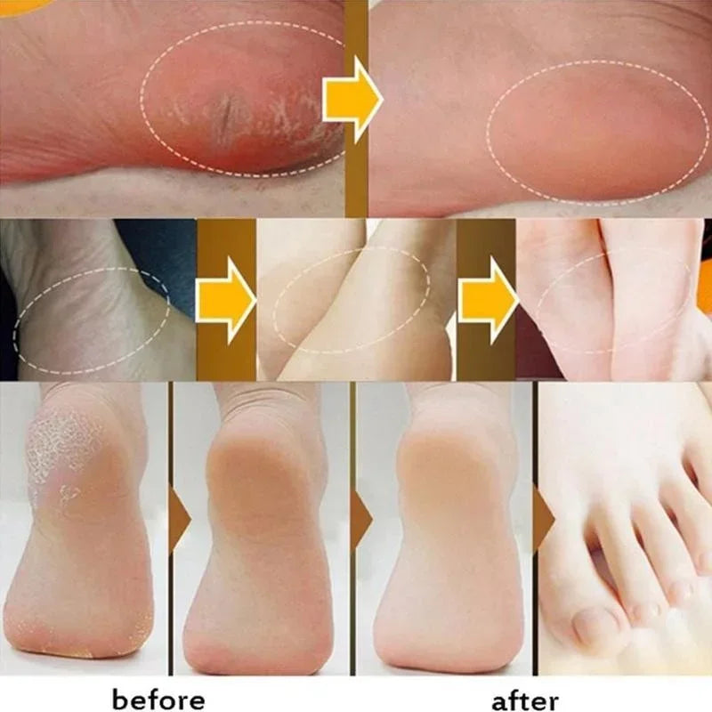 Beauty Product Herbal Anti Crack Foot Cream Heel Cracking Repair Products Exfoliation Dead Skin Removal Softening Moisturize