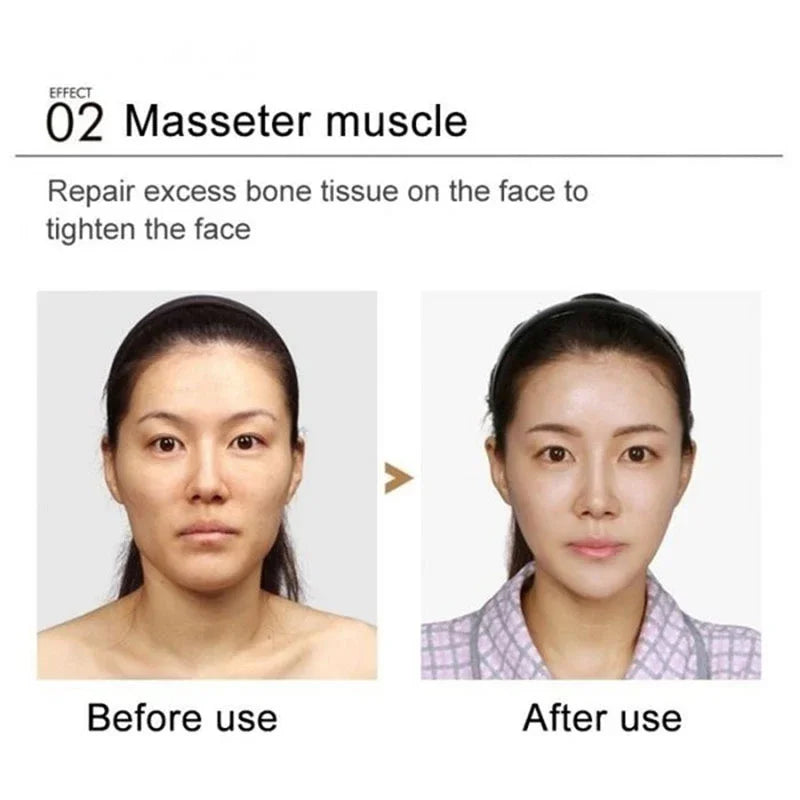 V-Shape Firming Face-lift Slimming Cream Removal Masseter Muscle Double Chin Face Fat Burning Anti-aging Products New