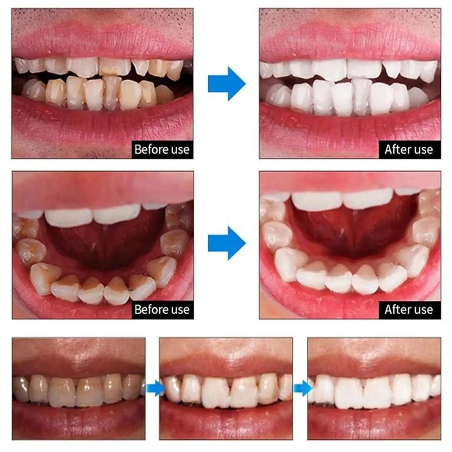 5 Days Teeth Whitening Powder Remove Plaque Stains Dental Calculus Oral Hygiene Cleaning Fresh Bad Breath Tooth Care Products